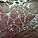 Living-Fascia